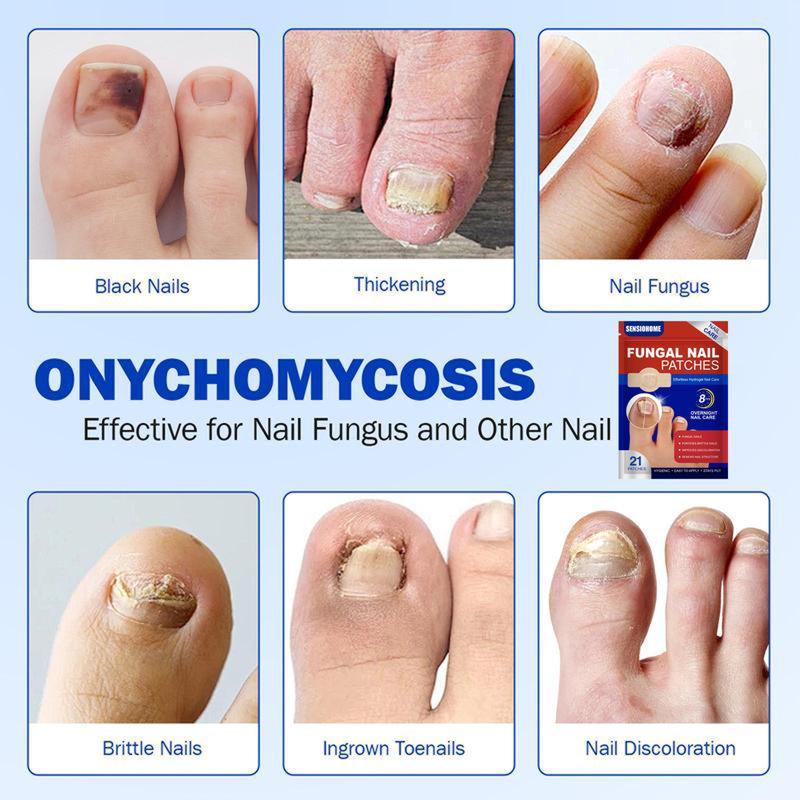 ToeVive Fungal Nail Patches
