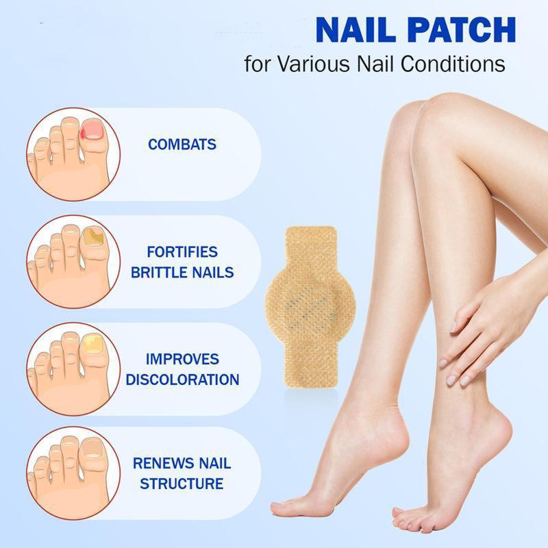 ToeVive Fungal Nail Patches