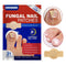 ToeVive Fungal Nail Patches